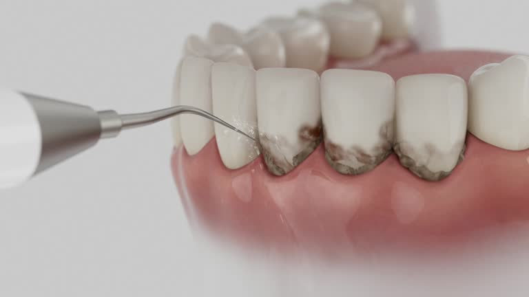 Reliable Dental contractor in Cresaptown, MD by Dentist Open Now
